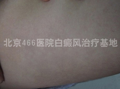 ŮȲ5