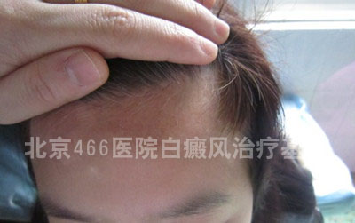 13ͯ沿9