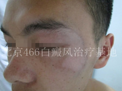 466ҽԺ沿20